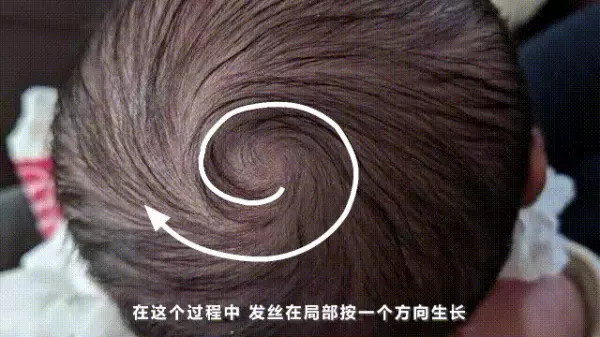 男人头上有一个旋的人命运怎么样(2)