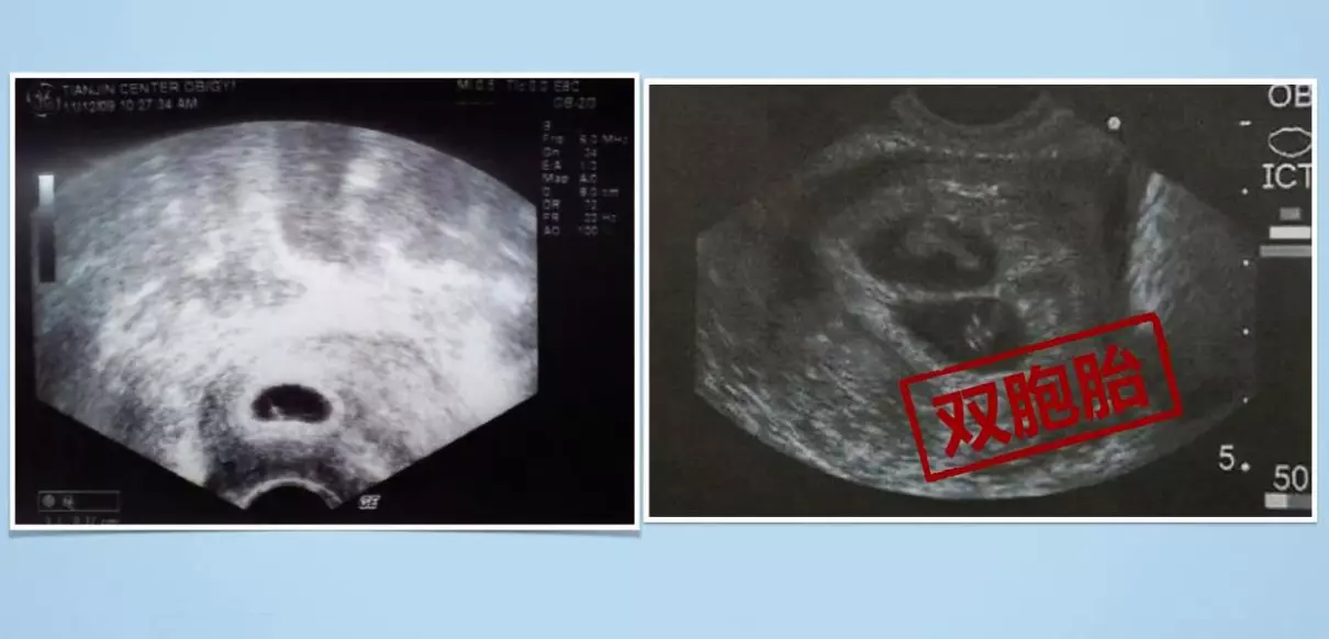 孕中期梦到流血了怎么回事周公解梦女(1)