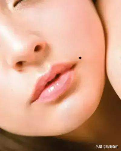 痣的位置与命运30处细看吉凶与富贵有关系吗(15)