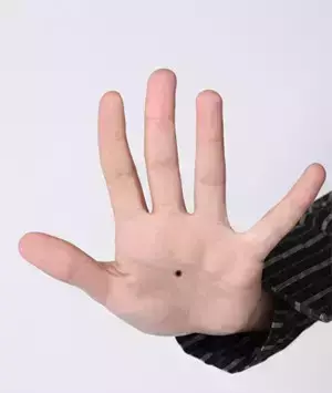 痣的位置与命运30处细看吉凶与富贵有关系吗(22)