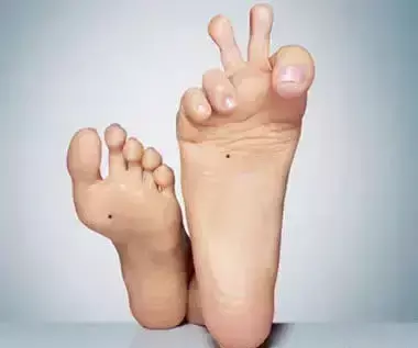 痣的位置与命运30处细看吉凶与富贵有关系吗(25)