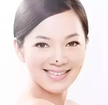 痣的位置与命运30处细看吉凶与富贵有关系吗(8)