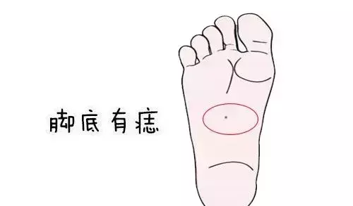 左脚后跟外侧有痣代表什么女人命运(3)