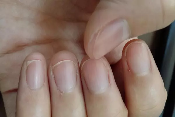 女人手腕纹有两条竖纹代表什么命运图解(1)