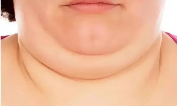 健康线与生命线相交命短吗(3)