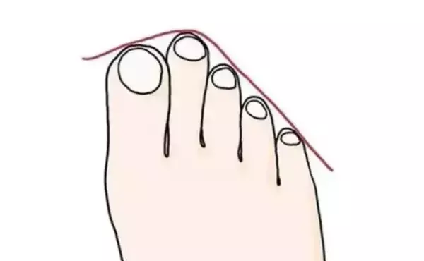 脚侧面长痣的女生代表什么命运呢图解(2)