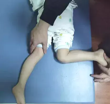 小孩子内八字看什么科室好(7)
