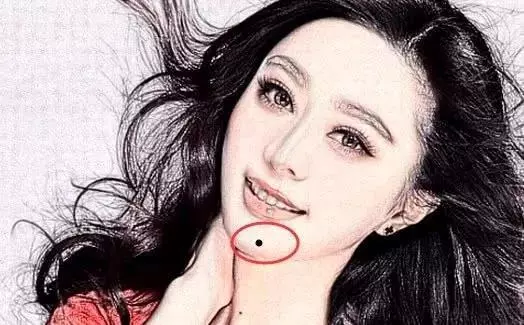 女人下巴长痣好不好 又代表什么(1)
