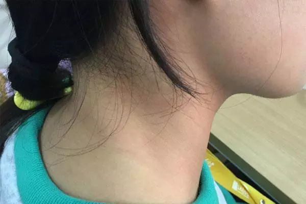 脖子上单独长一根长毛好不好(2)