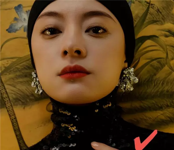 泪痣可以点掉吗会不会有什么影响(22)