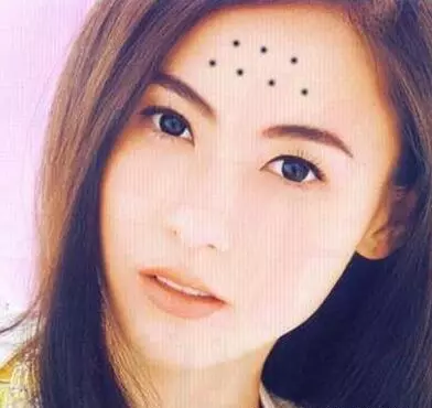面部哪些痣是好痣(3)