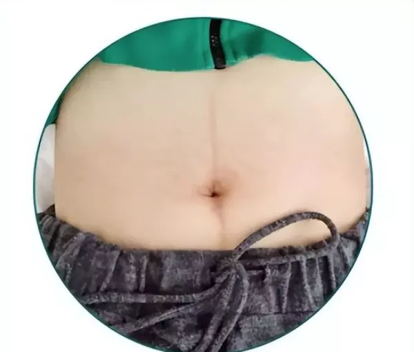 女人肚子上有两条竖线代表什么命运图解(5)