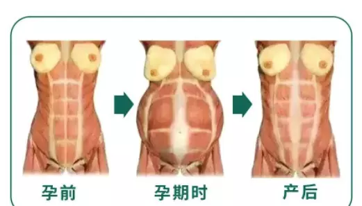 女人肚子上有两条竖线代表什么命运图解(9)