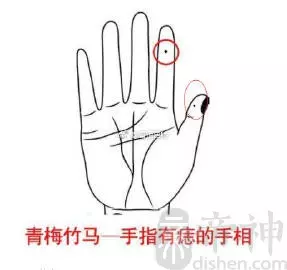 左手食指上有个痣意味着什么女人命运不好(1)