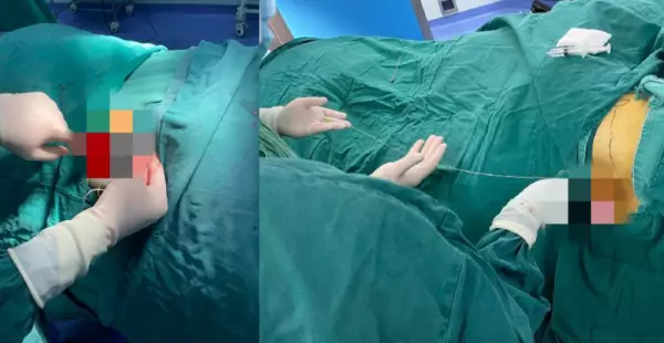 重医附二院楚磊教授怎么样(3)