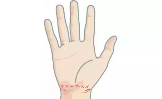 女士手掌三条线分开代表什么命运呢(5)