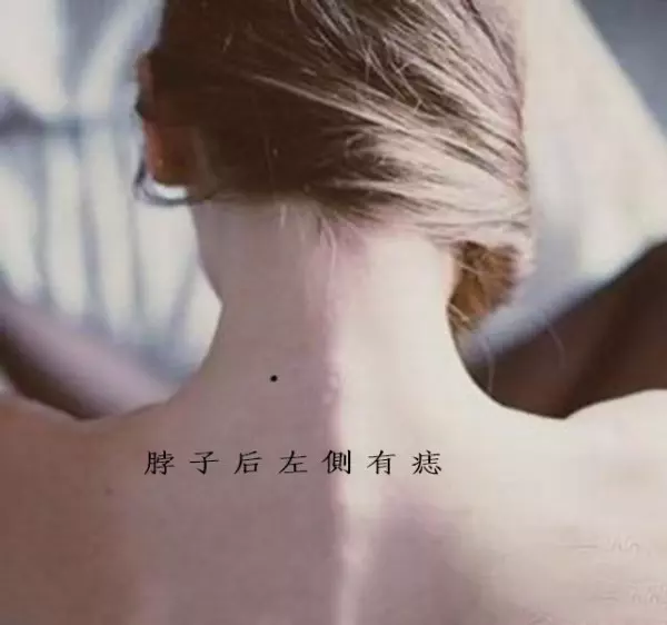 男人脖子后面有3个痣代表什么命运图解(1)