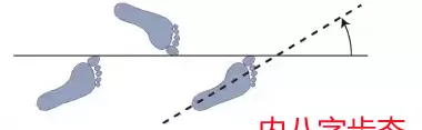 孩子内八字挂什么科室(3)