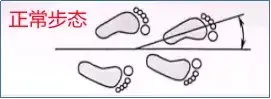 孩子内八字挂什么科室(4)