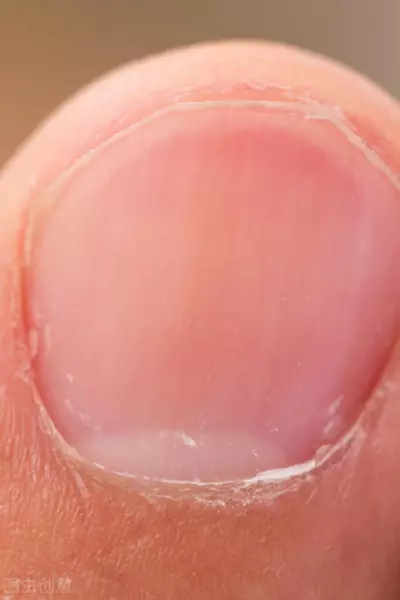 男人手指上的月牙慢慢的变少了是怎么回事(1)