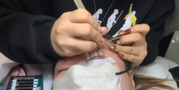 一个眼睛双一个眼睛单是怎么回事(4)