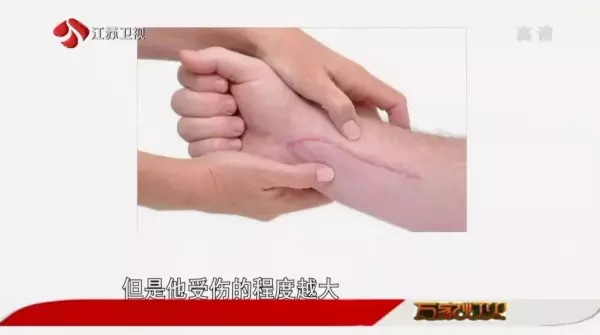 脸上的疤痕比其他部位的容易恢复吗(4)