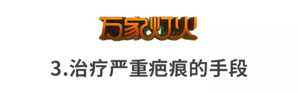 脸上的疤痕比其他部位的容易恢复吗(6)