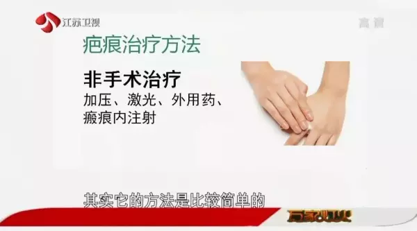 脸上的疤痕比其他部位的容易恢复吗(7)