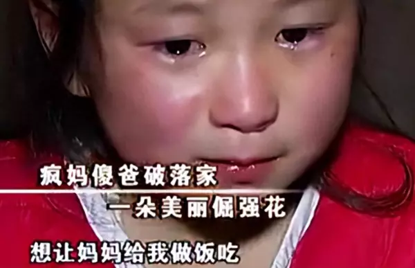 9岁小女孩掉头发掉的很严重是怎么回事(1)