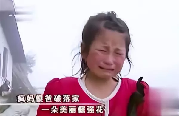 9岁小女孩掉头发掉的很严重是怎么回事(2)