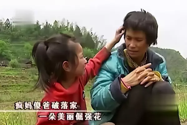 9岁小女孩掉头发掉的很严重是怎么回事(3)