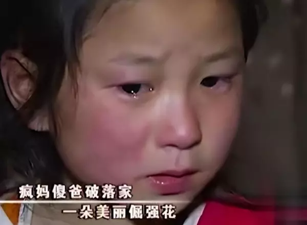 9岁小女孩掉头发掉的很严重是怎么回事(4)