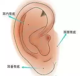 女人左耳耳廓有痣代表什么(1)