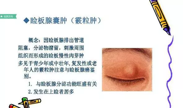 眼泡上长了个小疙瘩是怎么回事(1)