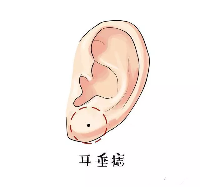 耳垂有三颗连着的痣表示什么命运男生(1)