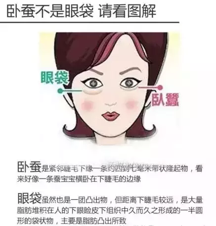 什么是卧蚕与眼袋的区别(1)