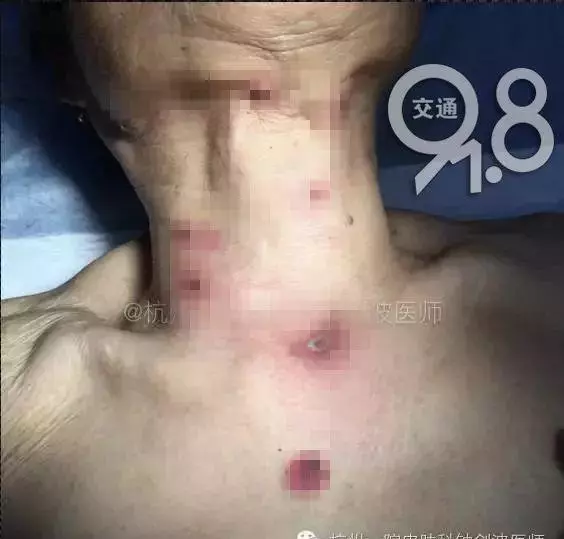 耳朵长痣图解大全(1)
