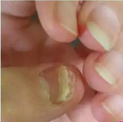 男生手上没有月牙竖条纹代表什么命运呢(10)