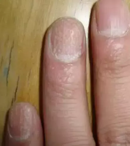 男生手上没有月牙竖条纹代表什么命运呢(11)
