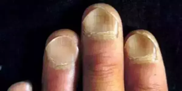 男生手上没有月牙竖条纹代表什么命运呢(13)