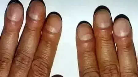 男生手上没有月牙竖条纹代表什么命运呢(14)