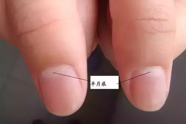 男生手上没有月牙竖条纹代表什么命运呢(2)