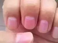男生手上没有月牙竖条纹代表什么命运呢(4)