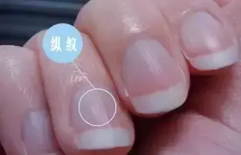 男生手上没有月牙竖条纹代表什么命运呢(6)