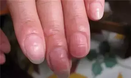 男生手上没有月牙竖条纹代表什么命运呢(8)