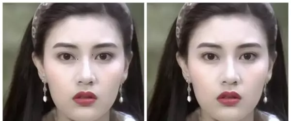 脸上什么地方的痣不能取(12)