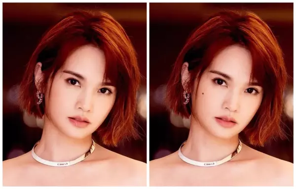 脸上什么地方的痣不能取(19)