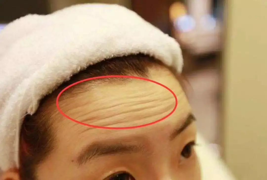 男人额头上纹路代表什么命运图解大全(2)